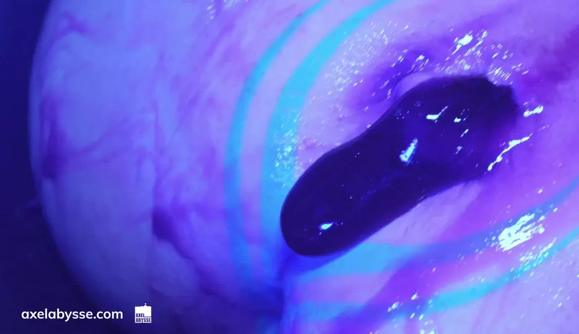 Fisting In The Sling: MNDFCUK & Axel Abysse 5